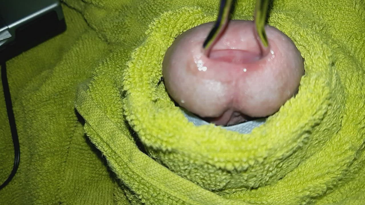 Stretched open peehole with an estim HFO. tens7000.