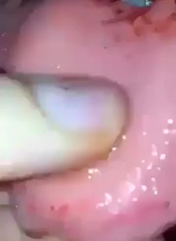 tongue rip