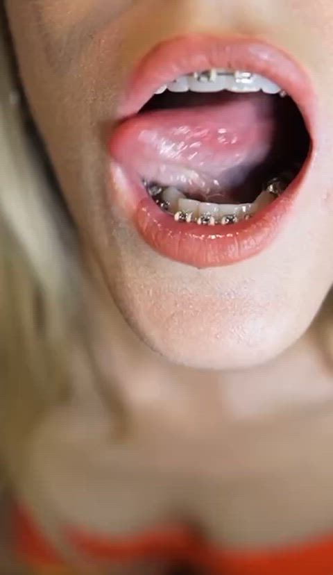 amateur blonde braces drool petite small tits spit tongue r/ddlg braceface clip