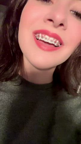 And my adult braces are back. Super painful, but nothing I can’t handle. Elastics
