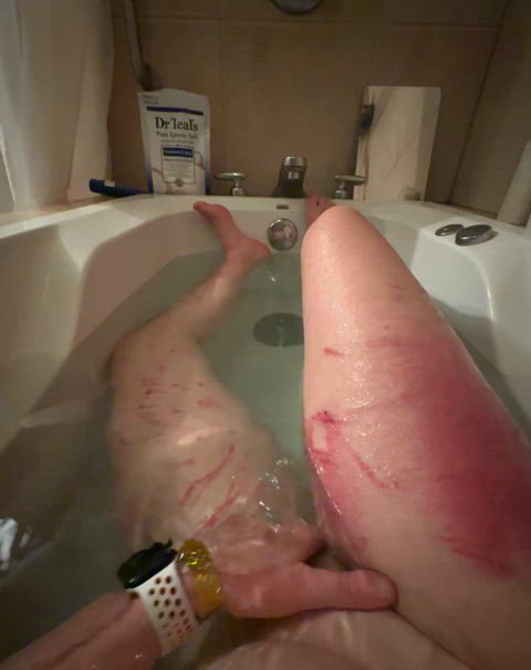 My dom beat me and put me in a hot bath to help the marks settle. Look how hard my