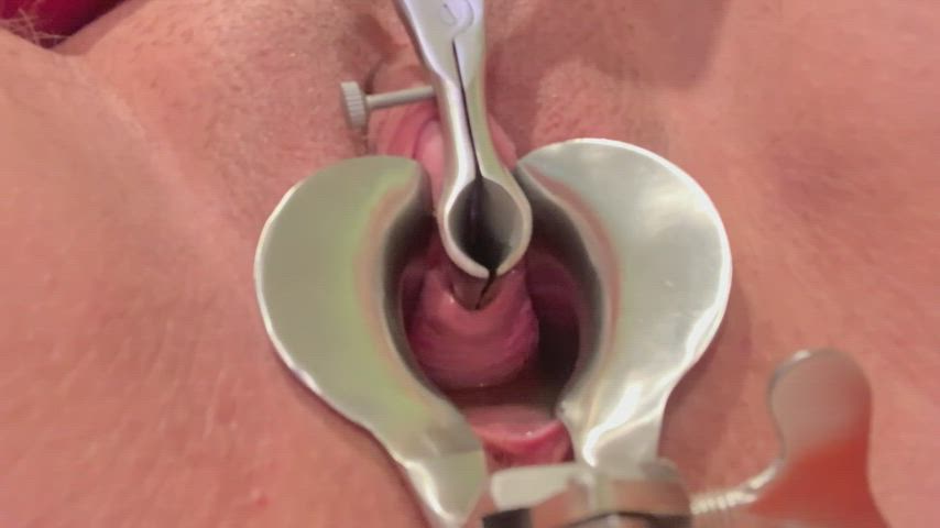 close up extreme medical fetish pee piss clip