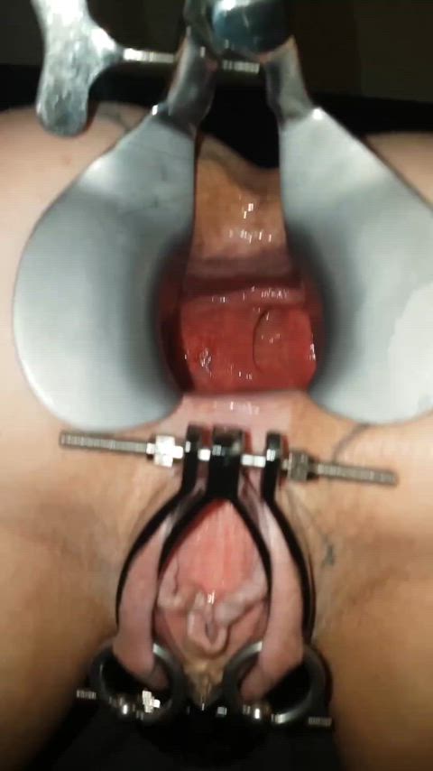 anal speculum ass spread close up pussy spread clip