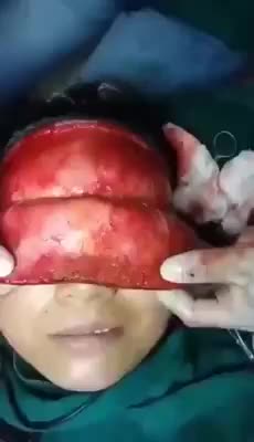 Surgeon plays around with patients face during surgery