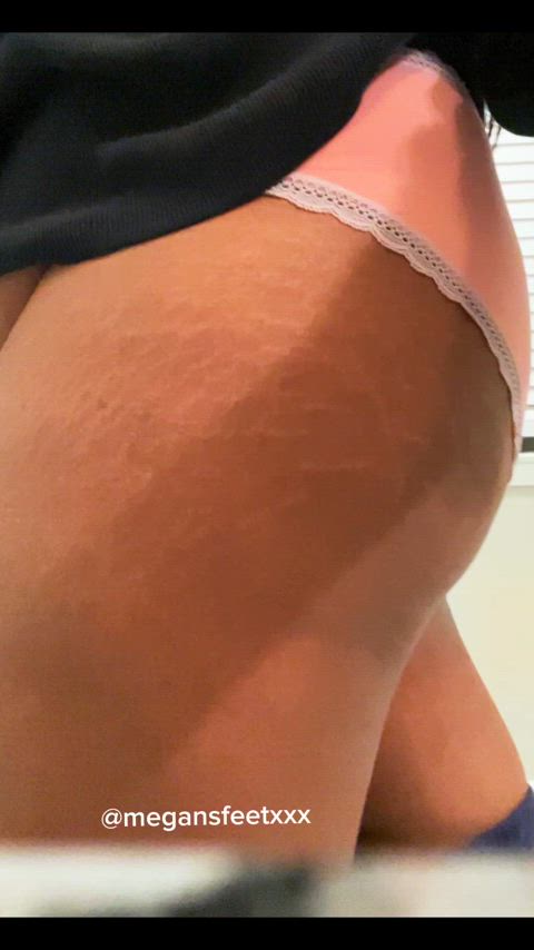 are stretch marks on the ass unattractive?