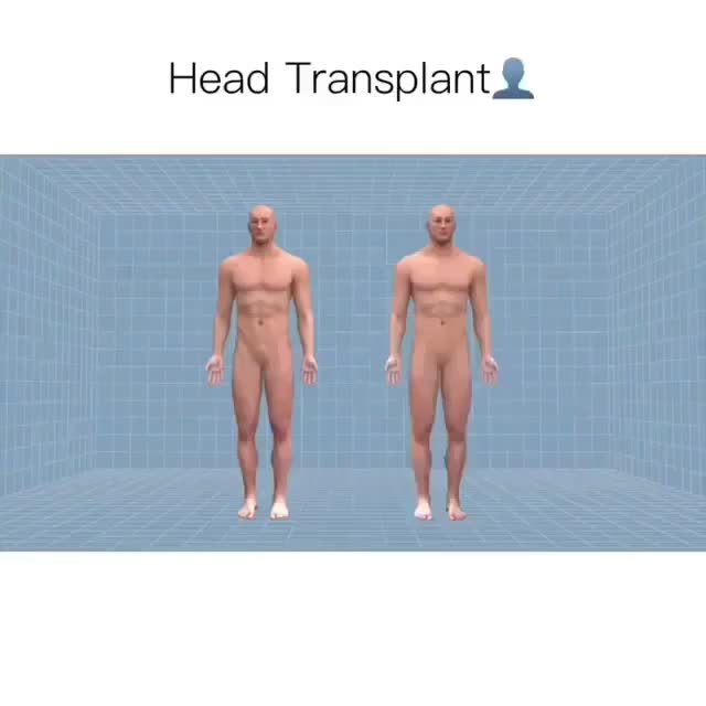 This is how head transplant is carried out [theoretically]
