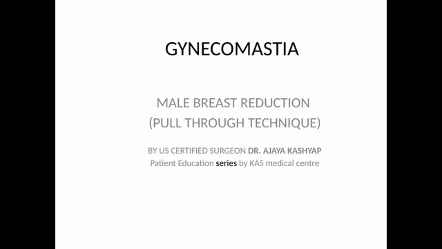 Male Breast Reduction (Pull Through Techniques) by Dr. Ajaya Kashyap