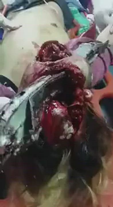 Guy's head destroyed by piece of metal
