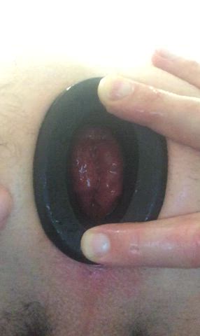 asshole butt plug gape gaping hole prolapse clip