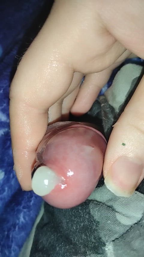 Pus leaking from a penis 