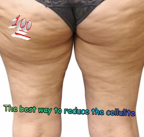 fasciablaster the tool to get rid of cellulite