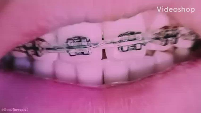 braces cumshot teen clip