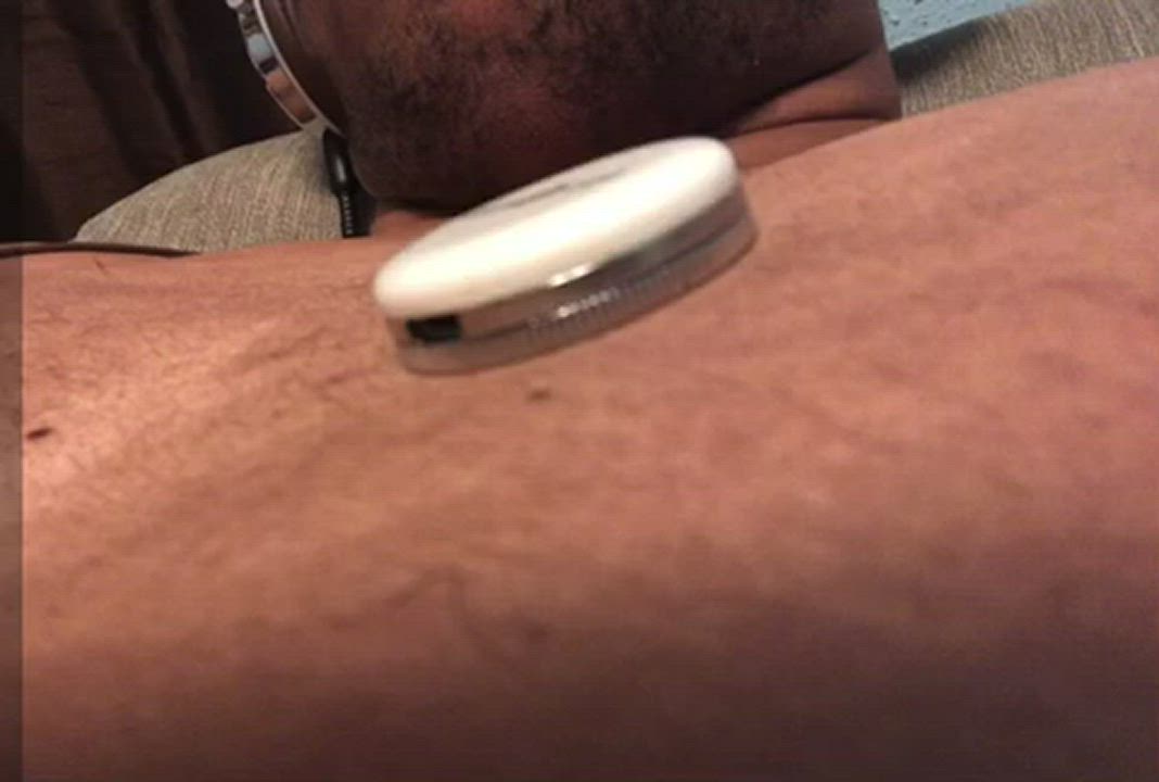 African American Ebony Medical Medical Fetish clip