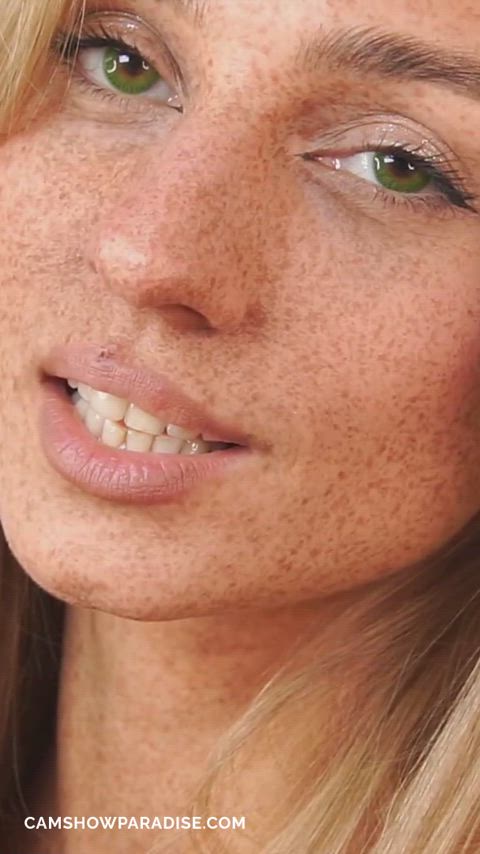 freckles beauty, anyone?