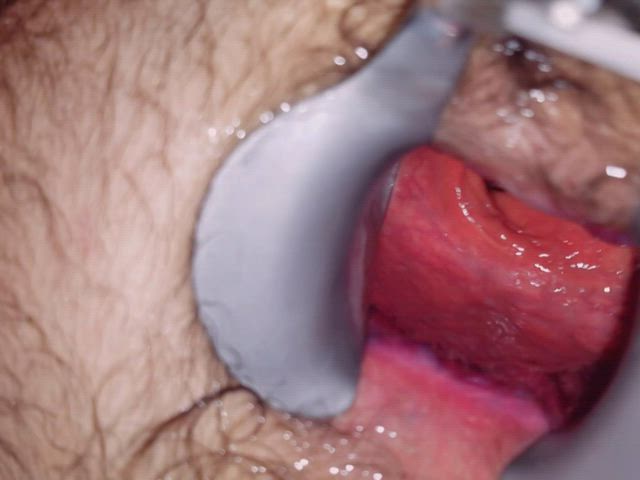 Closeup view down my open guts through a dilator