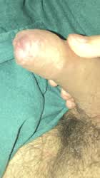 Cock Foreskin Gay clip