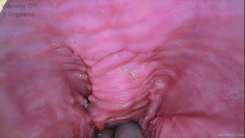 fetish gaping medical medical fetish pink pussy spread spread spreading pussy pussy-spreading